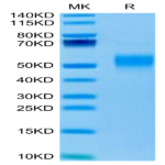 Mouse Fc gamma RI/CD64 Protein (FRI-MM164)