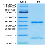 Human FcRn Protein (FRN-HM101)