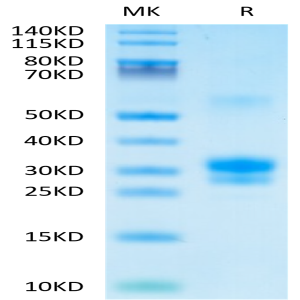 Human TNFSF15 Protein (FSF-HM115)