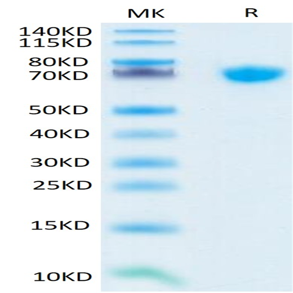 Human TNFSF15 Trimer Protein (FSF-HM415)