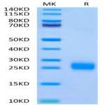 Human FSHB Protein (FSH-HM10B)