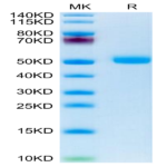Human FSHB Protein (FSH-HM201)