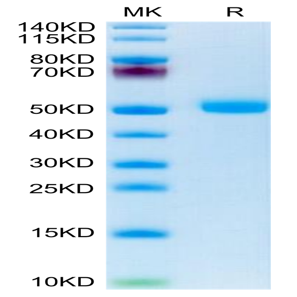 Human FSHB Protein (FSH-HM201)