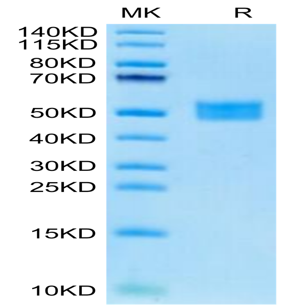 Human FSTL1 Protein (FST-HM1L1)
