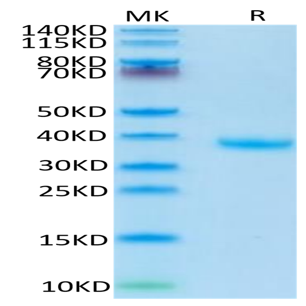 Human FSTL3 Protein (FTS-HM1L3)