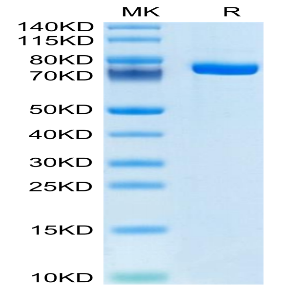 Human Factor XI Protein (FXI-HM101)