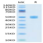Human Galectin 1 Protein (GAL-HM201)