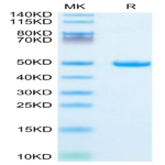 Mouse Galectin 1 Protein (GAL-MM201)