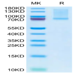 Mouse GAS6 Protein (GAS-MM106)