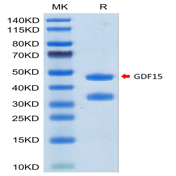 Human GDF15 Protein (GDF-HM215)