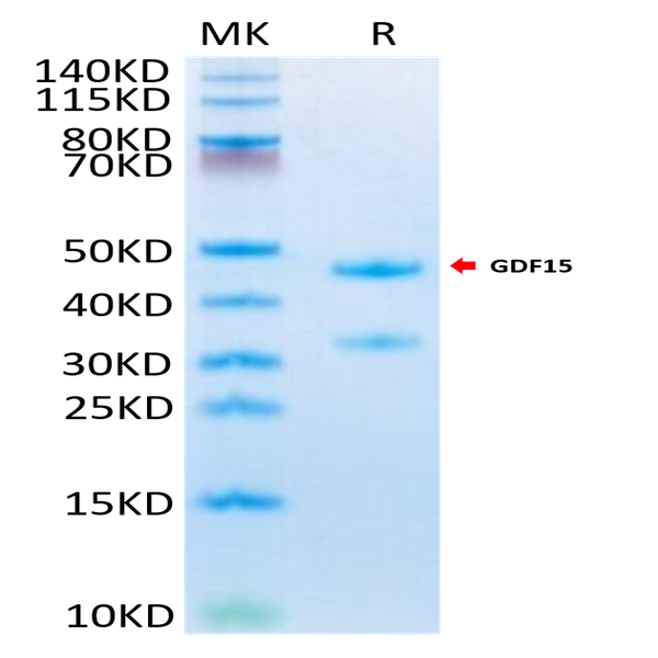 Mouse GDF15 Protein (GDF-MM215)