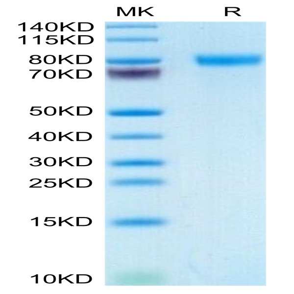 Human GEP Protein (GEP-HM101)