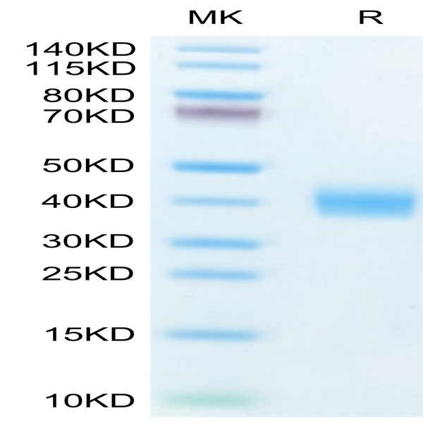 Human Galectin 3 Protein (GLT-HM103)