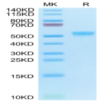 Cynomolgus GPVI Protein (GP6-CM101)