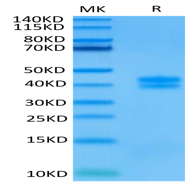 Human GPA33/A33 Protein (GPA-HM433)