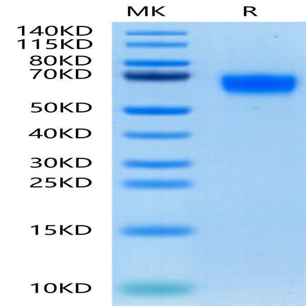 Human GM-CSF R alpha Protein (GSF-HM1RA)
