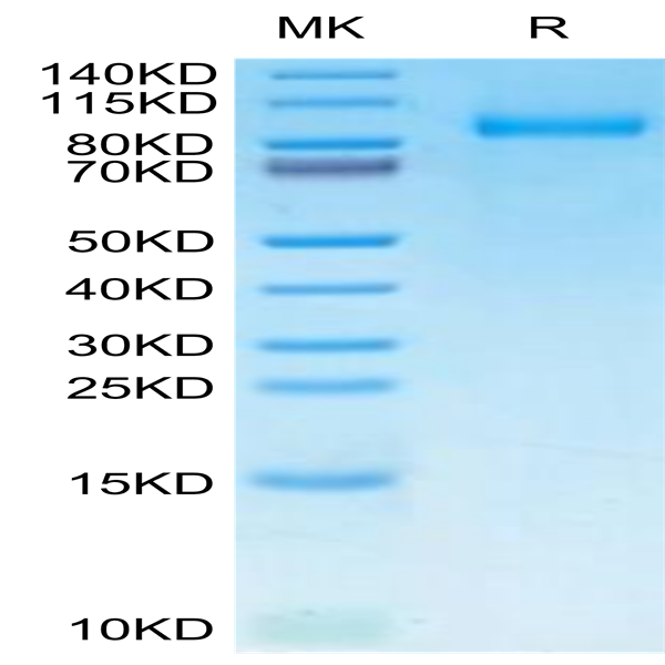 Human G-CSF R/CD114 Protein (GSR-HM101)