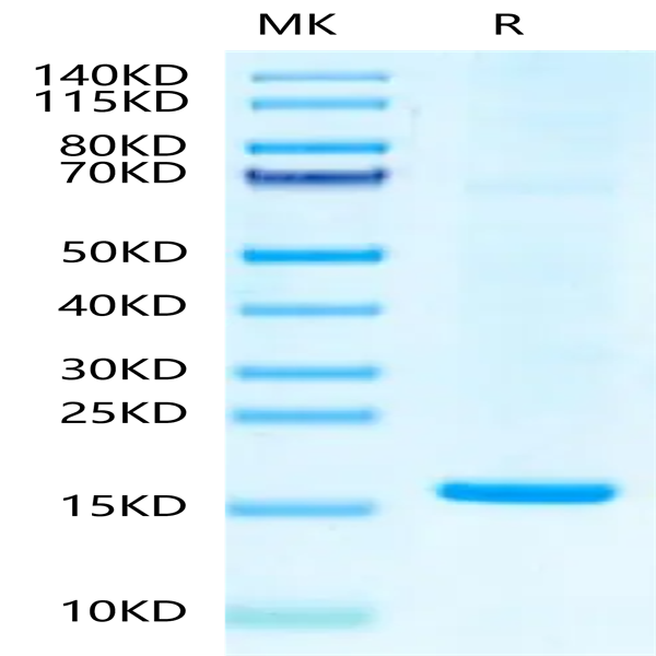 Hepatitis B Virus (HBV) (ayw/France/Tiollais/1979) Capsid Protein (HBV-VE101)
