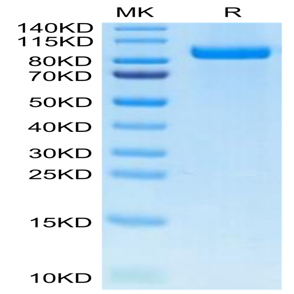Cynomolgus/Rhesus macaque Her3 Protein (HER-CM403)