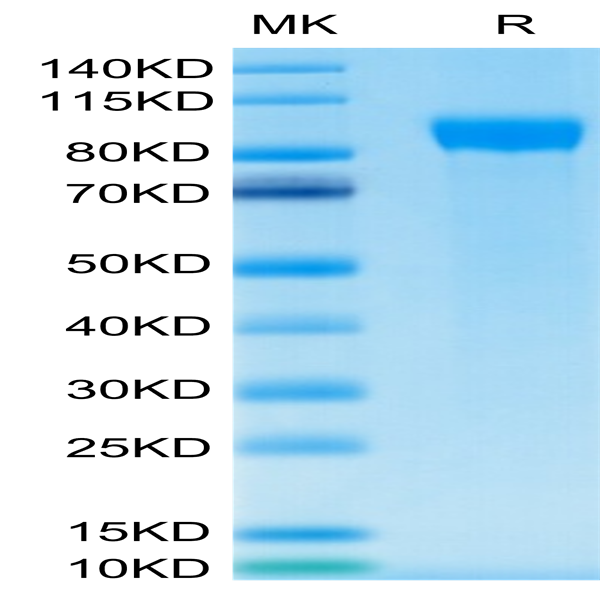 Human Her2/ErbB2 Protein (HER-HM402)