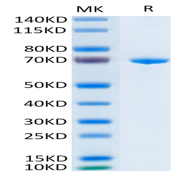 Human Her3/ErbB3 Protein (HER-HM403)