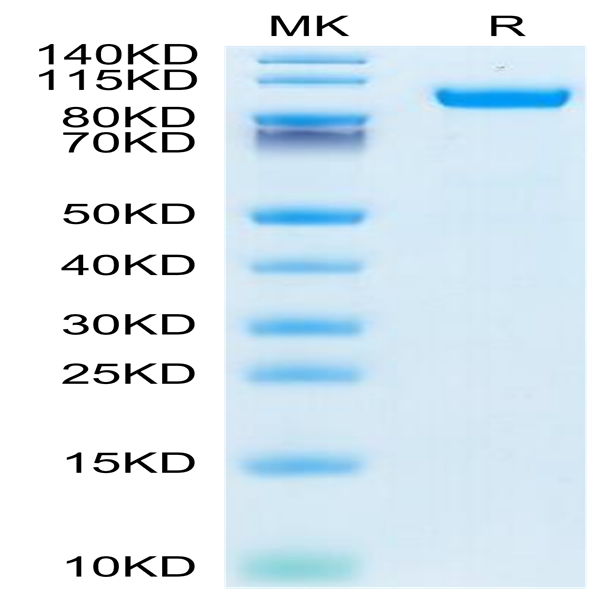 Human HGFA Protein (pro form) (HGF-HM10A)