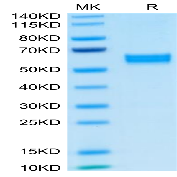 Human HGF Protein (HGF-HM201)