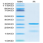 Mouse HPN Protein (HPN-MM101)