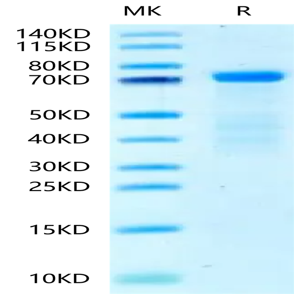 Human HRG/HPRG Protein (HRG-HM101)