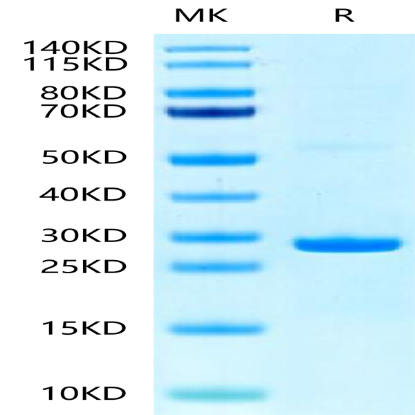 Human Hsp27/HSPB1 Protein (HSP-HE001)