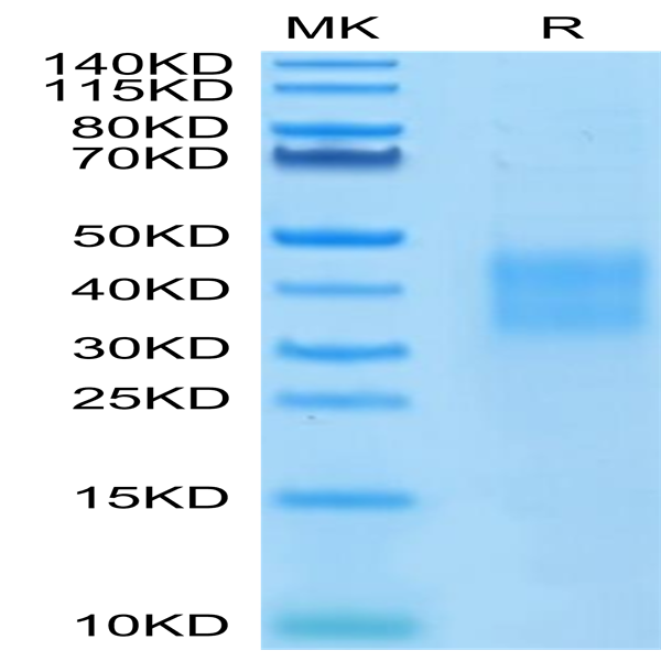 Human HVEM/TNFRSF14 Protein (HVE-HM111)