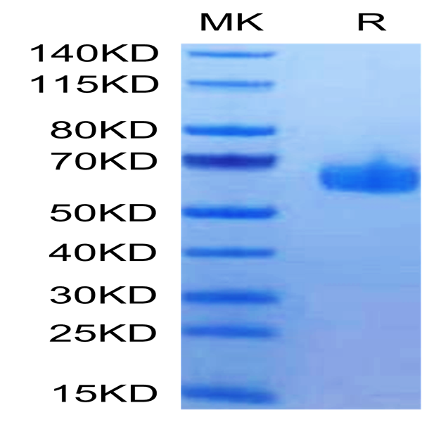 Human HVEM/TNFRSF14 Protein (HVE-HM211)