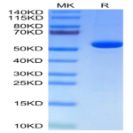 Human Hyaluronidase 2/HYAL2 Protein (HYA-HM101)