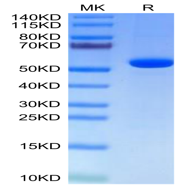 Human Hyaluronidase 2/HYAL2 Protein (HYA-HM101)