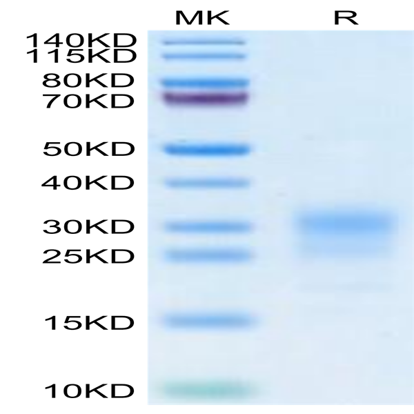 Cynomolgus IFN gamma/IFNG Protein (IFN-CM10G)