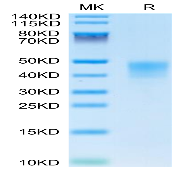 Human IFN alpha/beta R2 Protein (IFN-HM10R)