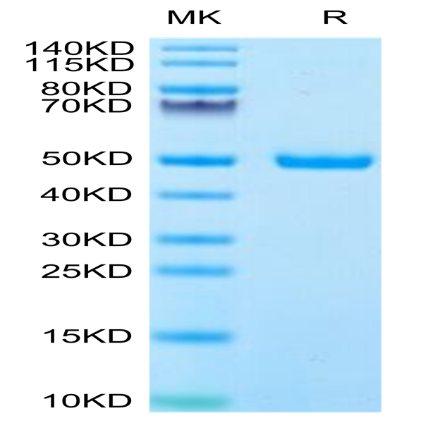 Human IFN alpha 1 Protein (IFN-HM2A1)