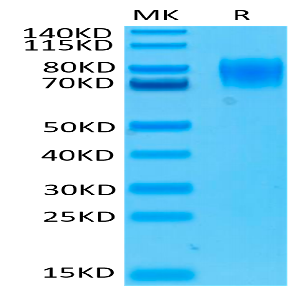 Human IFN alpha/beta R1 Protein (IFN-HM4R1)