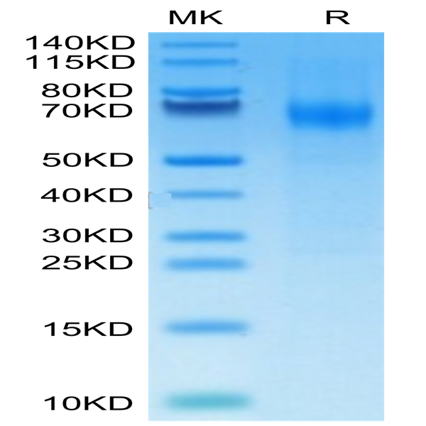 Mouse IFN alpha/beta R1 Protein (IFN-MM4R1)