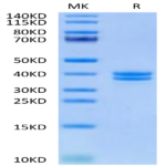 Human IGFII Protein (IGF-HM202)