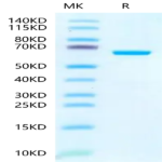 Human IGFBP-7 Protein (IGF-HM207)