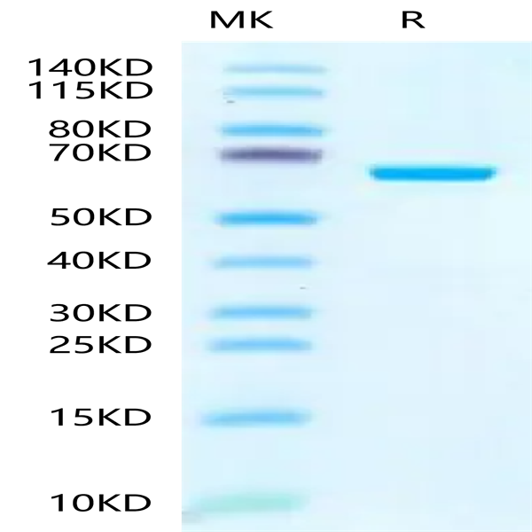 Human IGFBP-7 Protein (IGF-HM207)