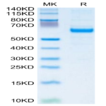 Human IGFBP-3R Protein BP004647 Syd Labs