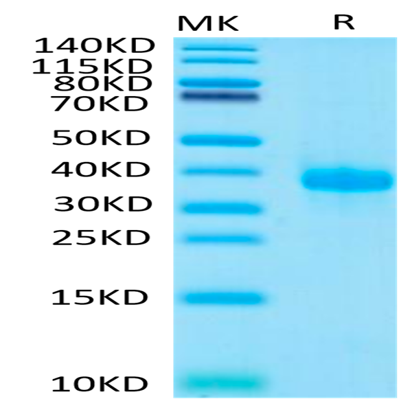 Human IGFBP-7 Protein (IGF-HM2BP)