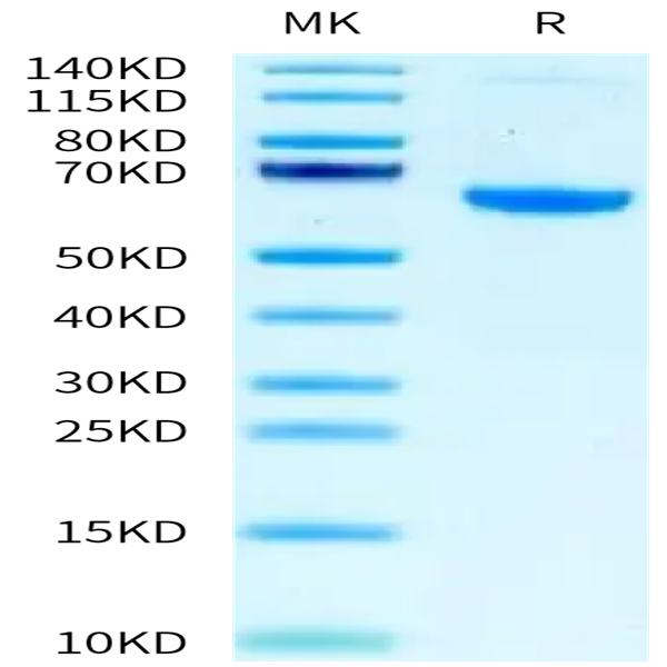 Mouse IGFBP-7 Protein (IGF-MM2BP)
