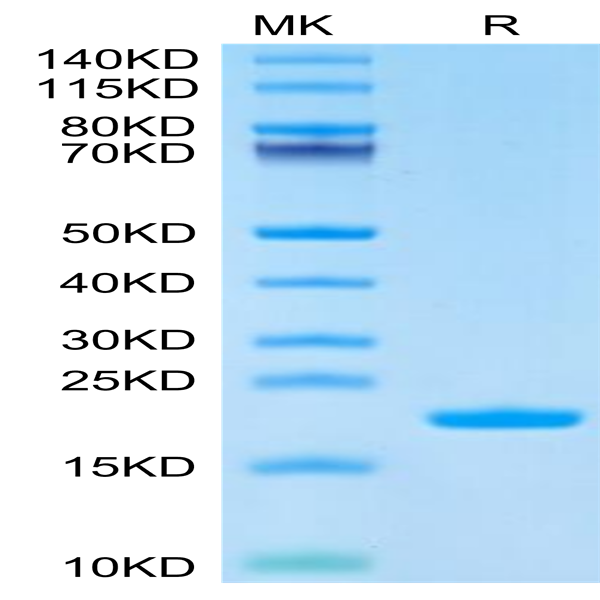 Cynomolgus IL-1 Beta/IL-1F2 Protein (IL1-CE10B)
