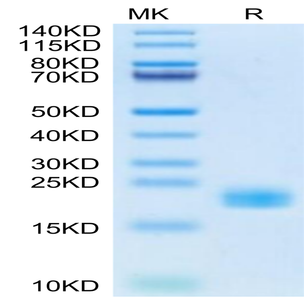 Cynomolgus IL-11 Protein (IL1-CM111)