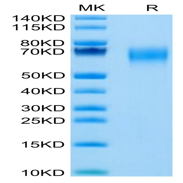 Cynomolgus IL-1 Rrp2/IL-1 R6 Protein (IL1-CM1L2)