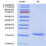 Human IL-18 Protein (IL1-HE018)