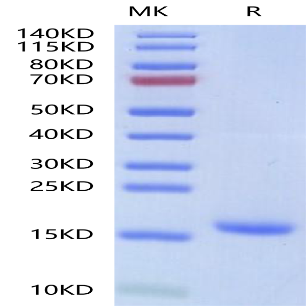 Human IL-18 Protein (IL1-HE018)